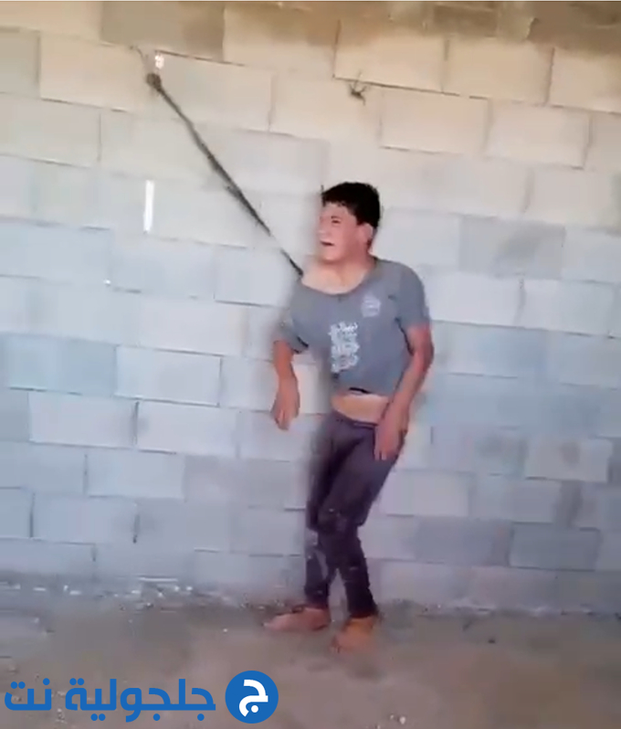 ضرب وتعذيب فتى من ذوي الاحتياجات الخاصة من قبل اقاربه في يطا